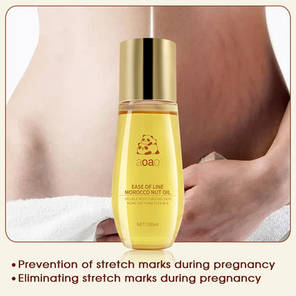 SALE 1 take 1 Maternity stretch marks OIL Prevention of stretch marks and Eliminating stretch marks during pregnancy